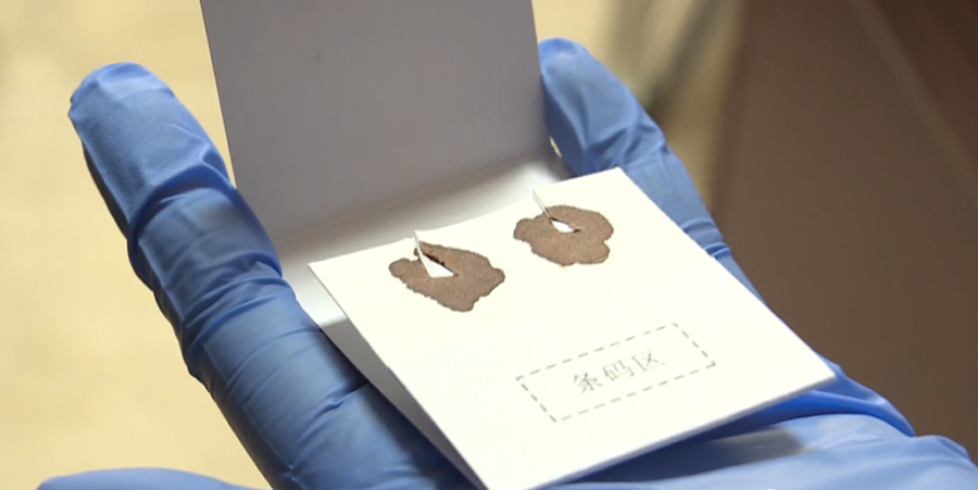 镇江个人亲子鉴定的流程,镇江个人亲子鉴定要多少钱