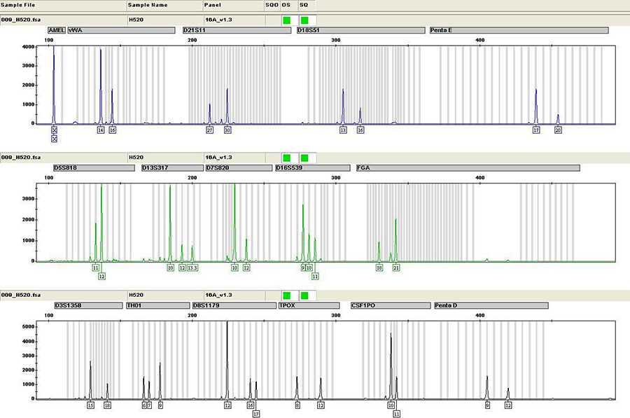 镇江上户口亲子鉴定如何办理,镇江上户口亲子鉴定办理流程